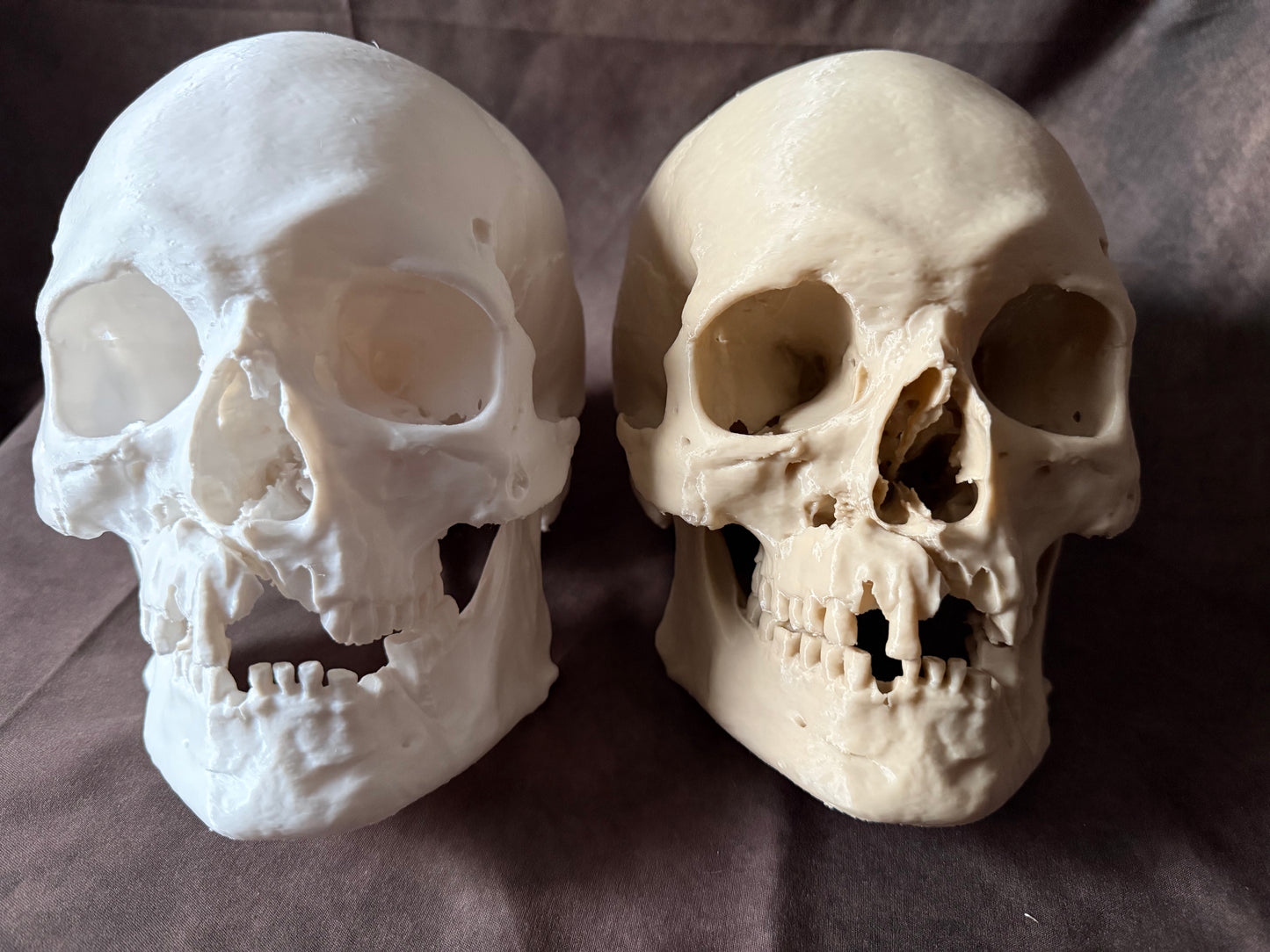 Battle-Damaged Human Skull Replica – Full Scale