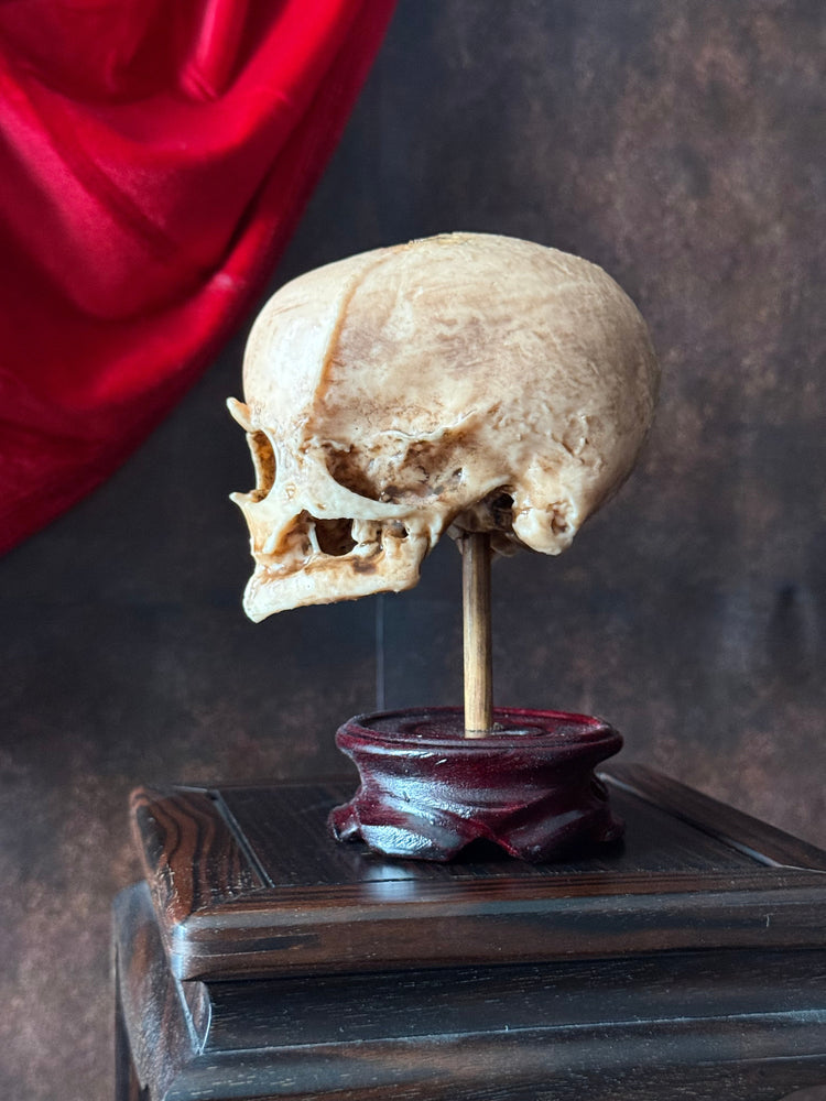 Side of Skull and curiosity 