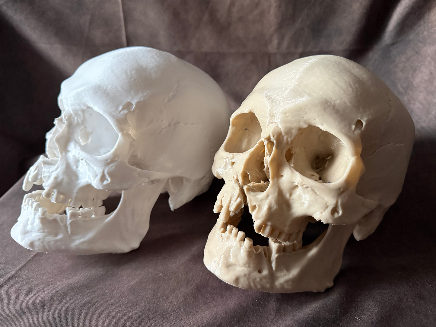 Battle-Damaged Human Skull Replica – Full Scale