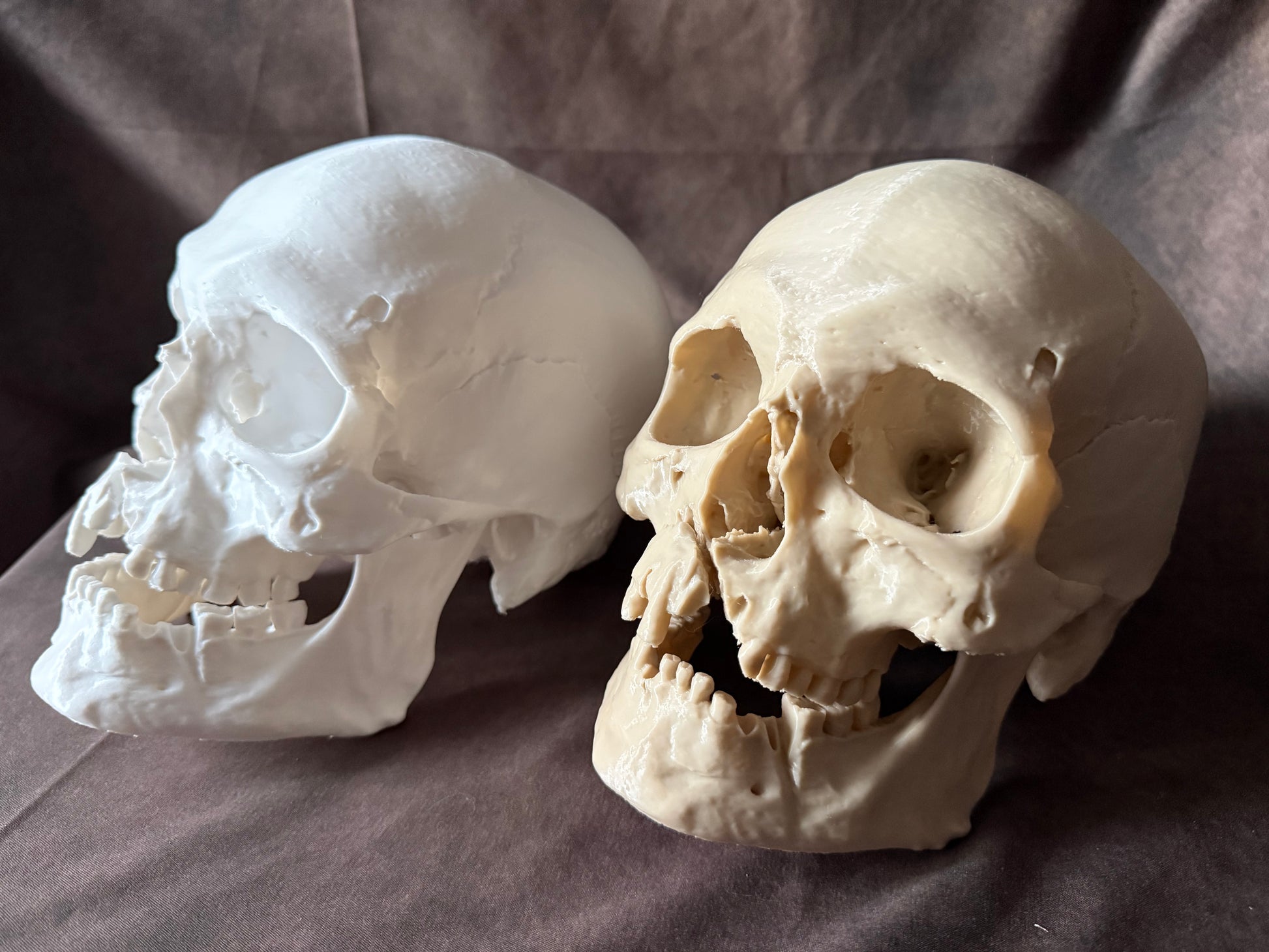 Battle-Damaged Human Skull Replica – Full Scale