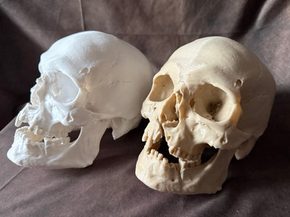 Battle-Damaged Human Skull Replica – Full Scale