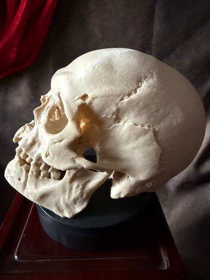 Battle-Damaged Human Skull Replica – Full Scale