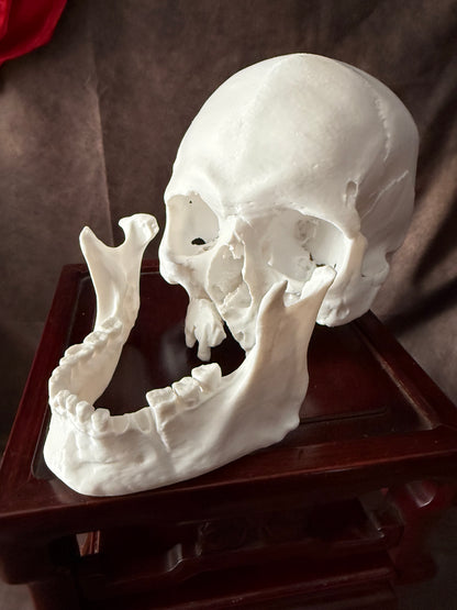 Battle-Damaged Human Skull Replica – Full Scale
