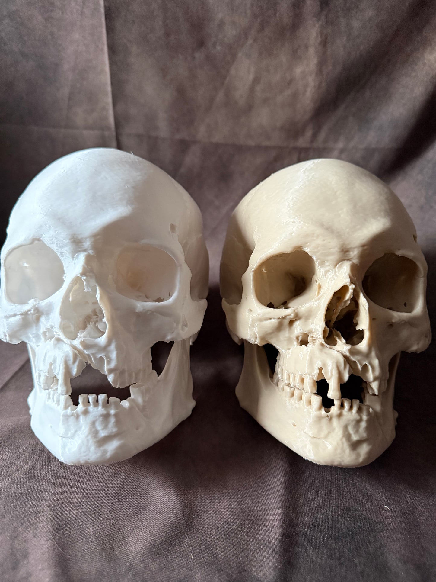 Battle-Damaged Human Skull Replica – Full Scale