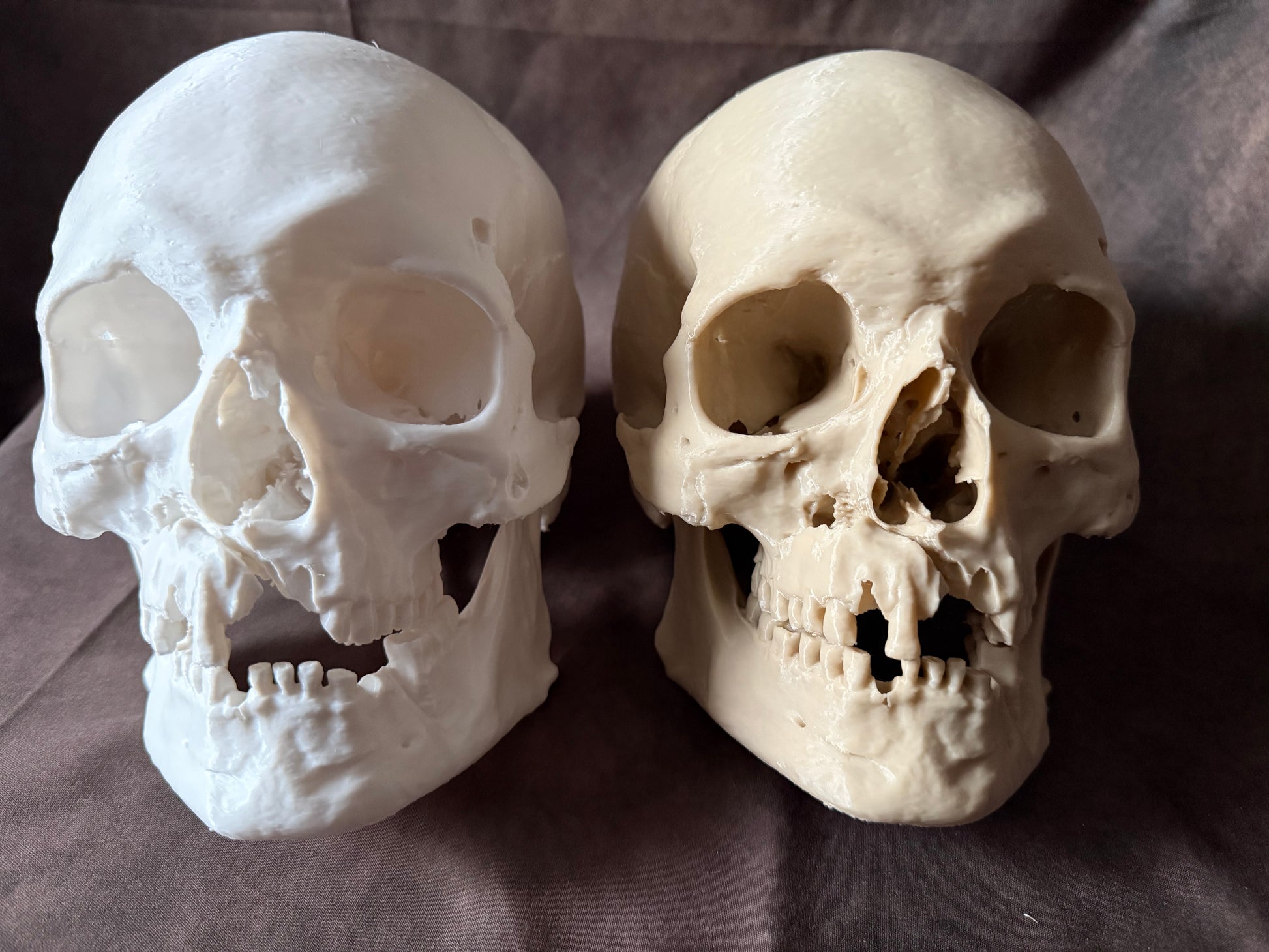 Battle-Damaged Human Skull Replica – Full Scale