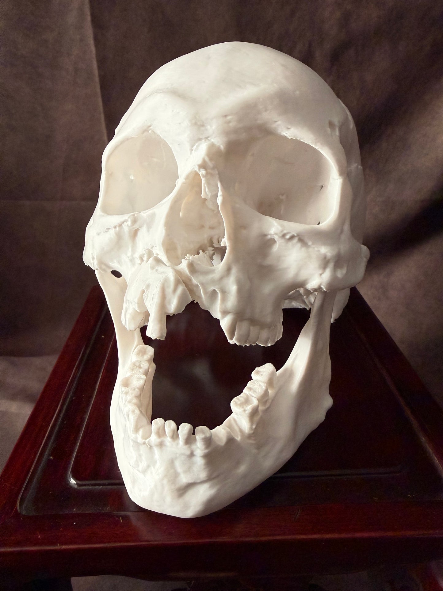 Battle-Damaged Human Skull Replica – Full Scale