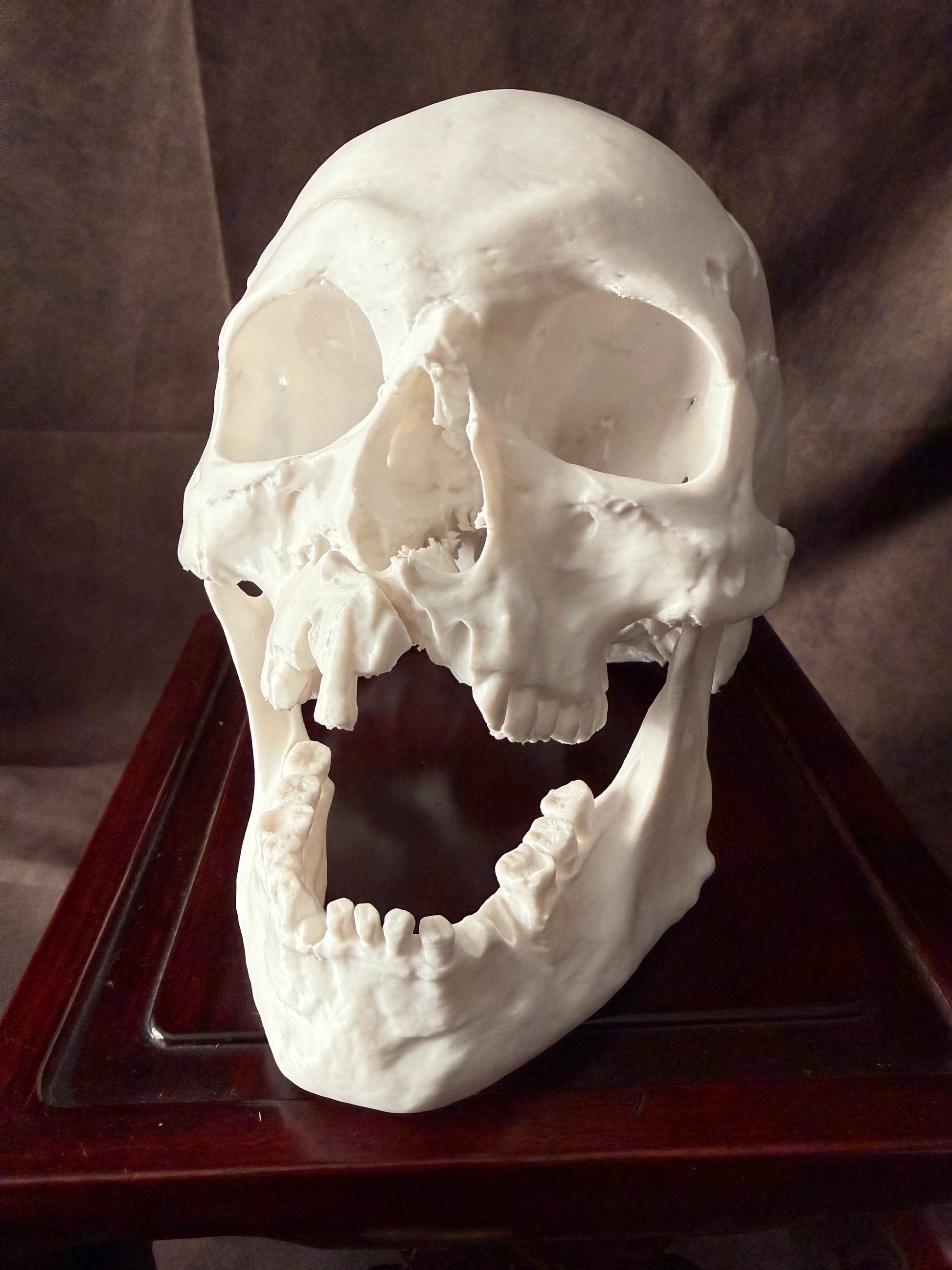 Battle-Damaged Human Skull Replica – Full Scale