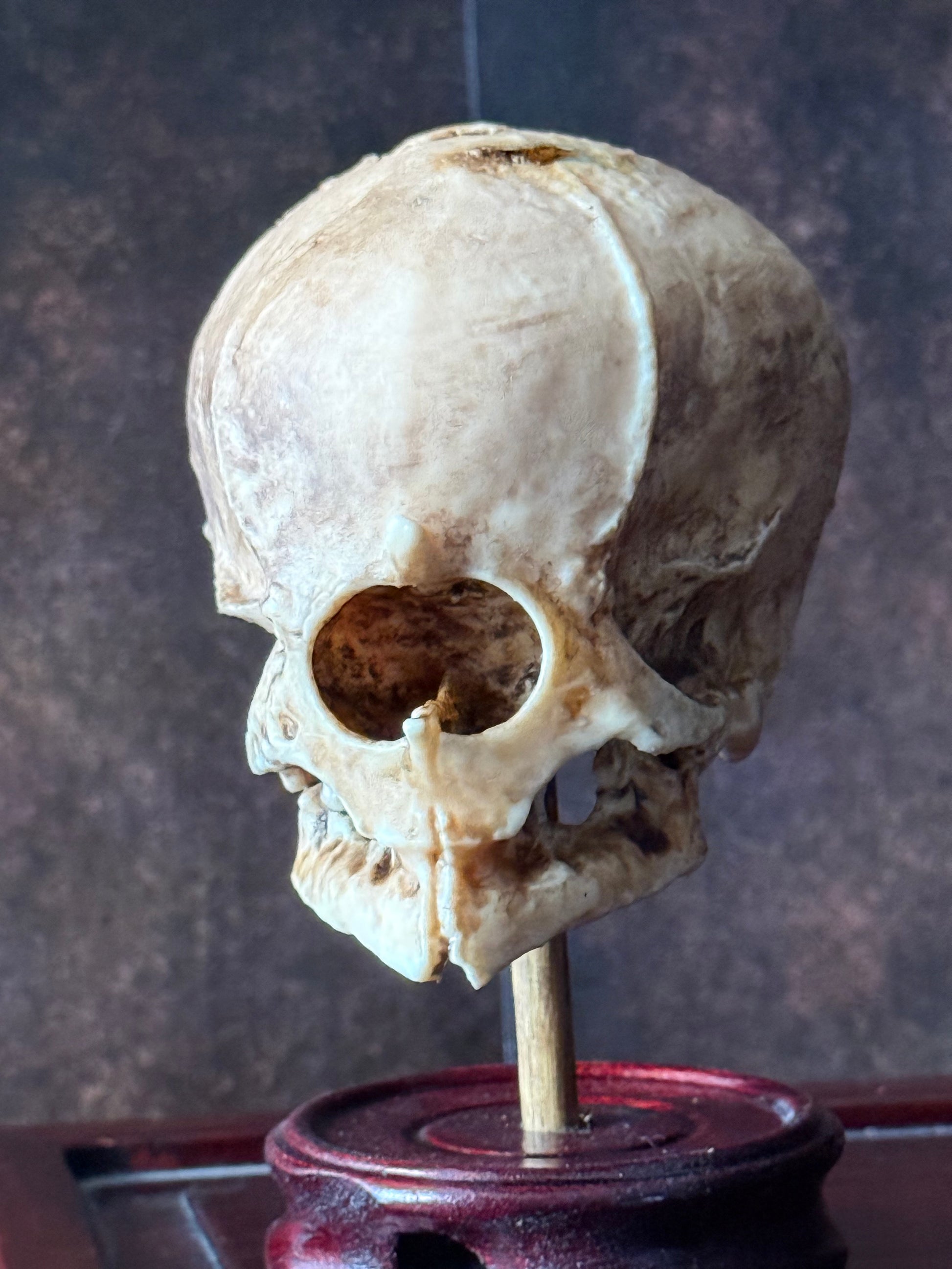 Cyclops Fetal Skull Specimen – Handmade Replica