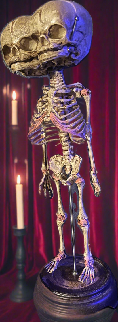 Screech & Silence – Two-Headed Fetal Skeleton Replica
