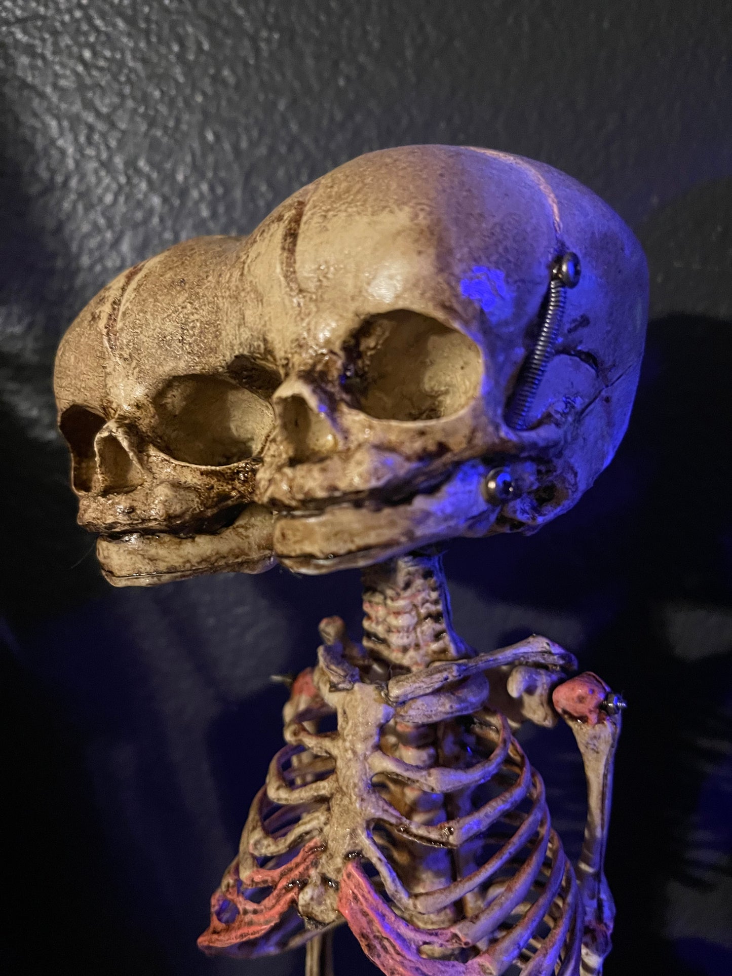 Screech & Silence – Two-Headed Fetal Skeleton Replica