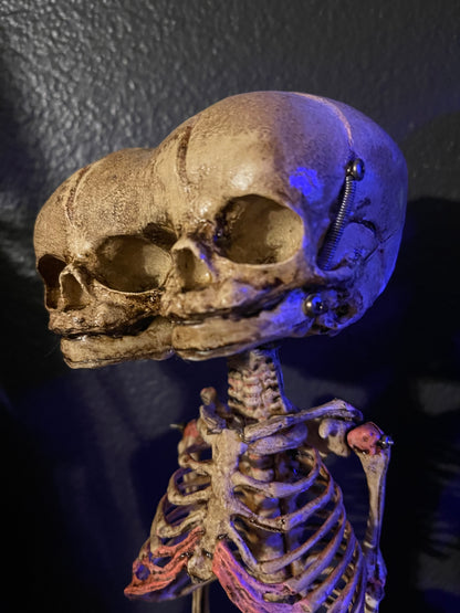 Screech & Silence – Two-Headed Fetal Skeleton Replica