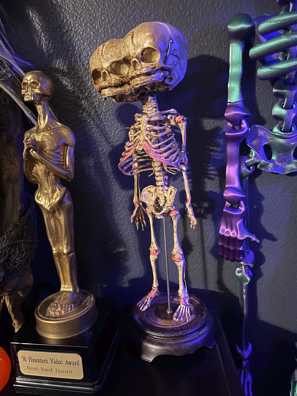 Two-Headed Conjoined Fetal Skeleton