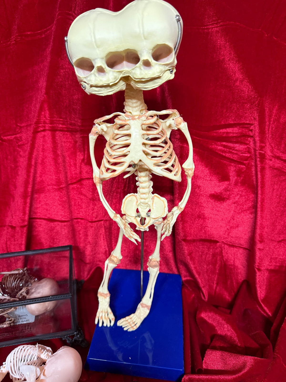 Two-Headed Conjoined Fetal Skeleton Bone w plastic base