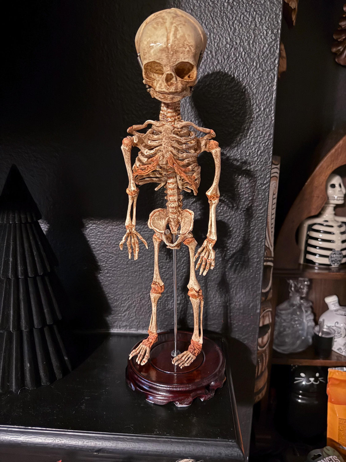 Fetal Skeleton Articulated