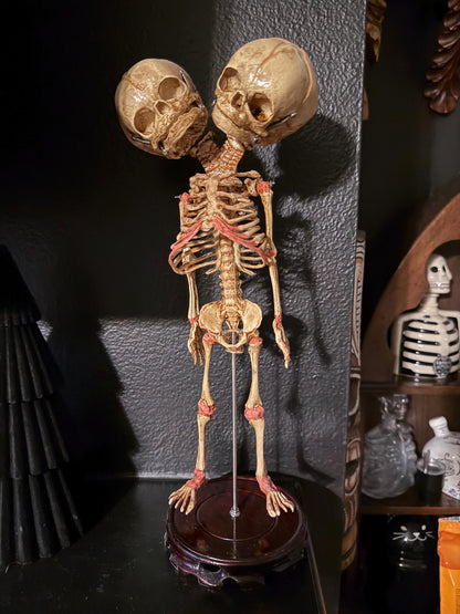 Two-Headed Conjoined Fetal Skeleton