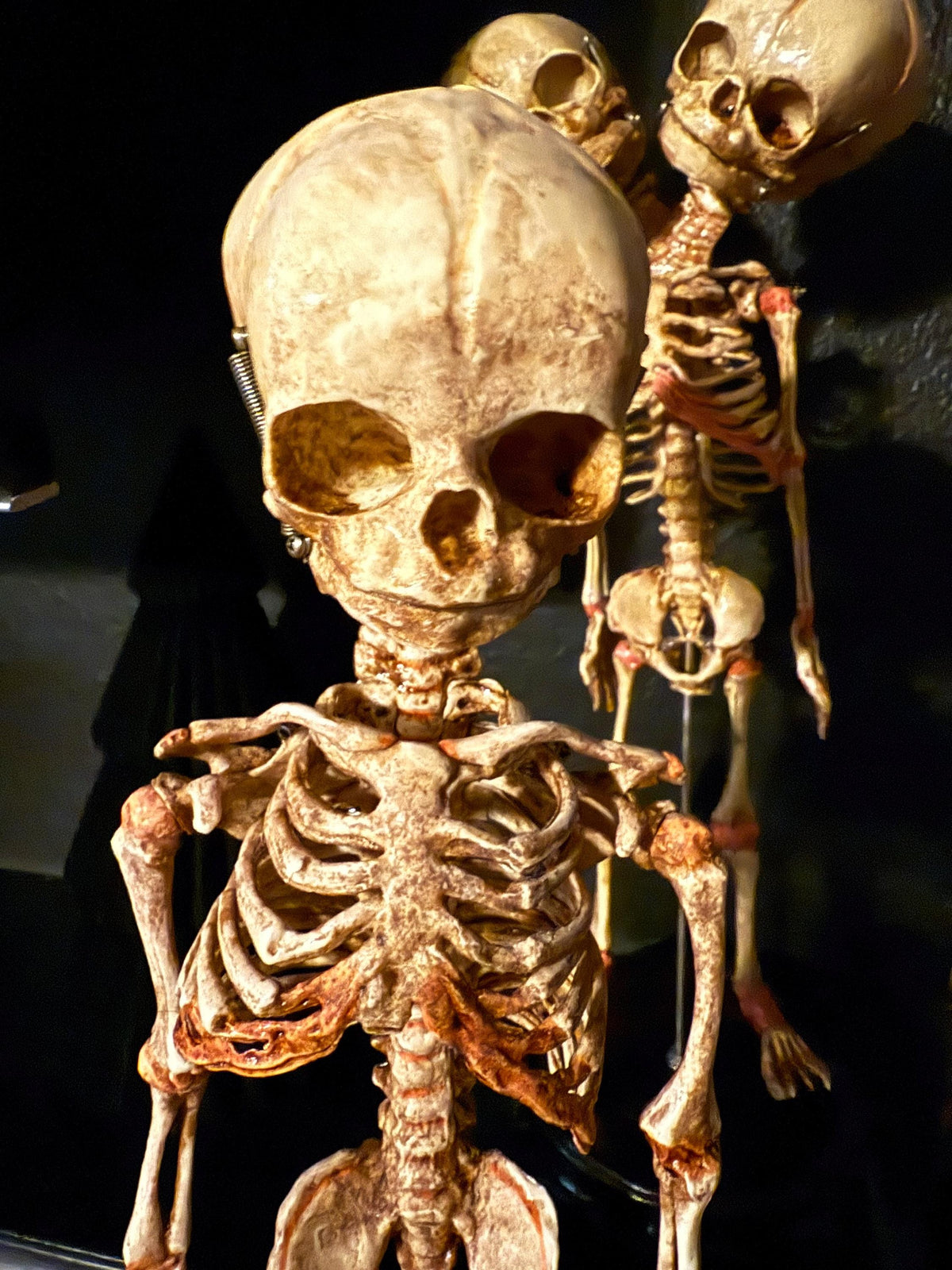 Two-Headed Conjoined Fetal Skeleton Skeleton w wood base