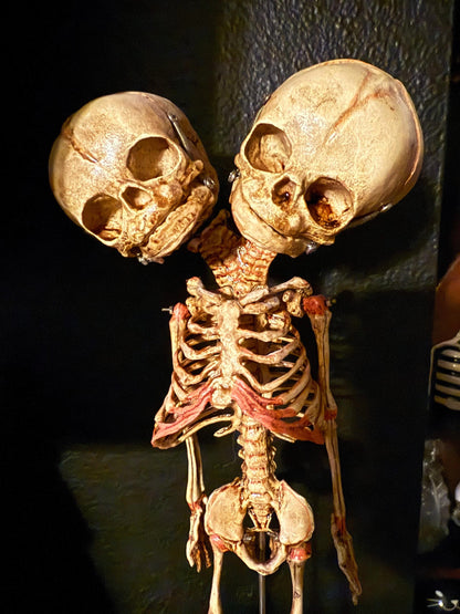 Two-Headed Conjoined Fetal Skeleton 2 head w wood base