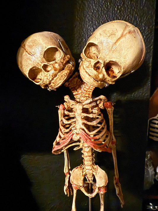 Two-Headed Conjoined Fetal Skeleton 2 head w wood base