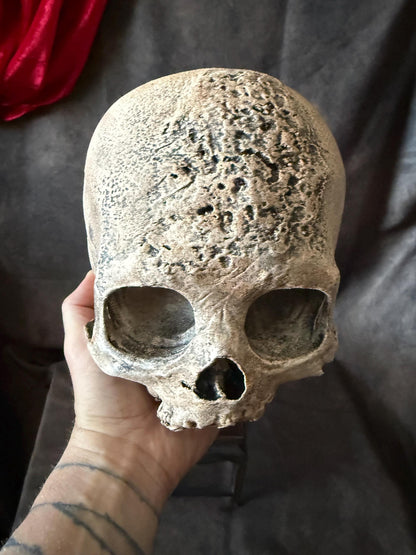 Syphillis Skull Replica | Pathological Medical Oddity Display (oversized)