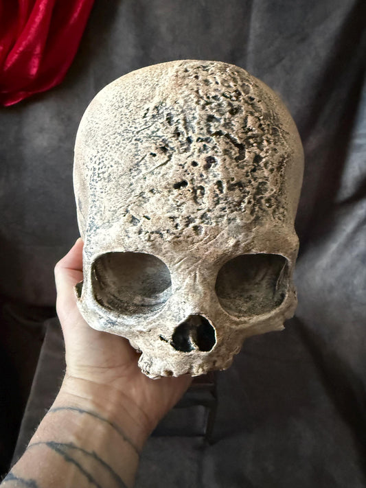 Syphillis Skull Replica | Pathological Medical Oddity Display (oversized)