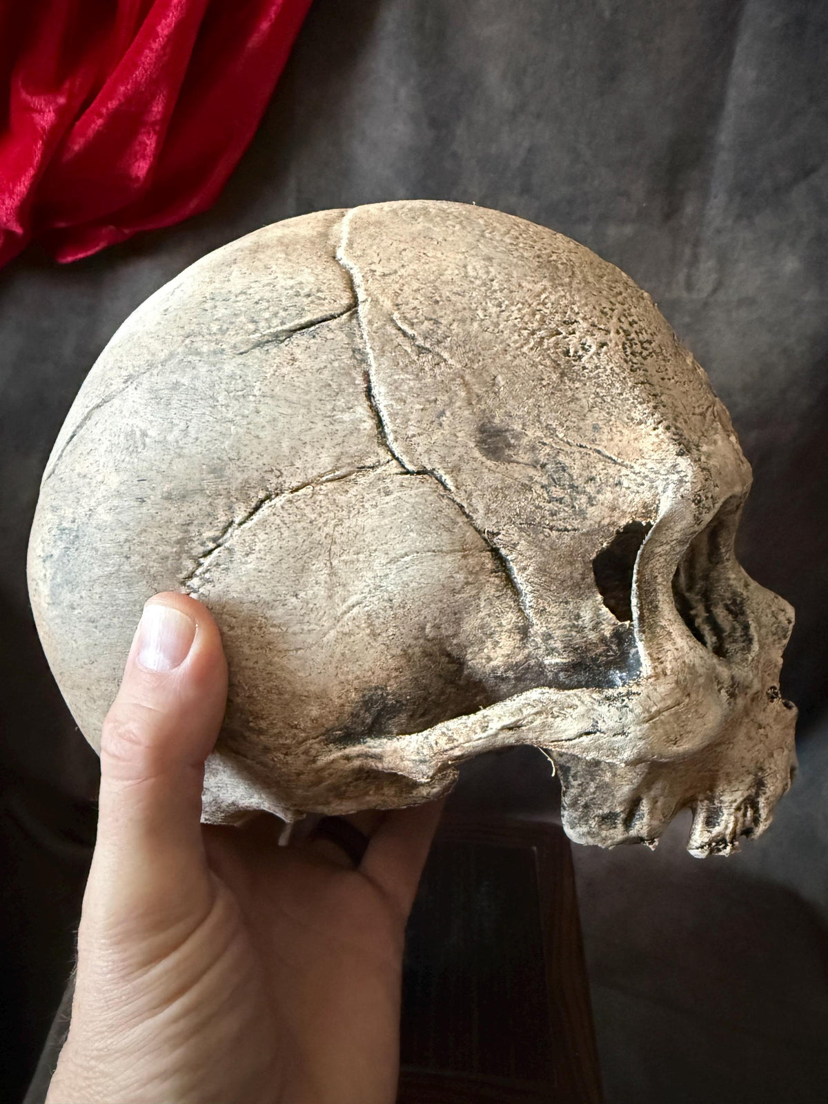 Syphillis Skull Replica | Pathological Medical Oddity Display (oversized)