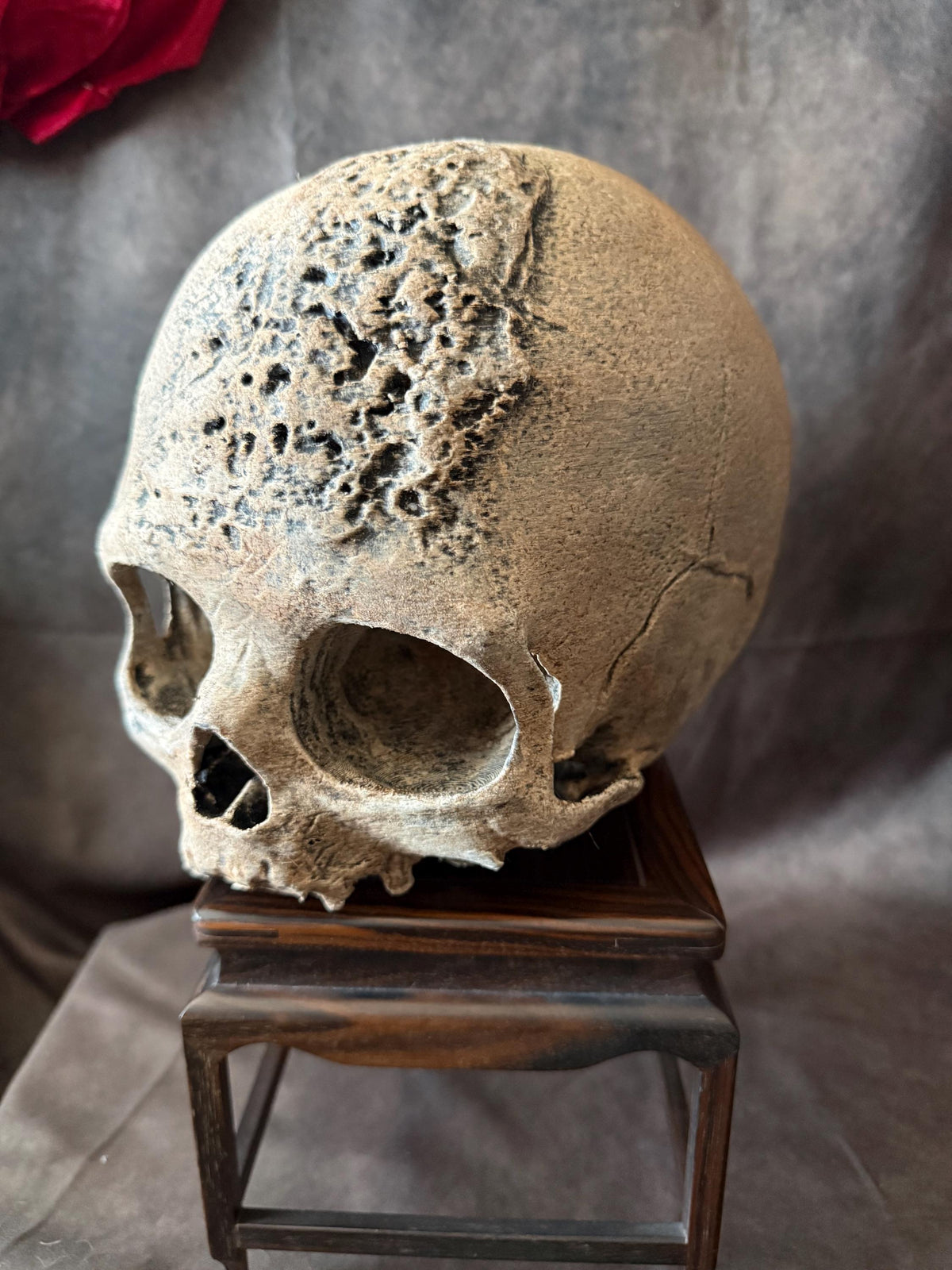 Syphillis Skull Replica | Pathological Medical Oddity Display (oversized)