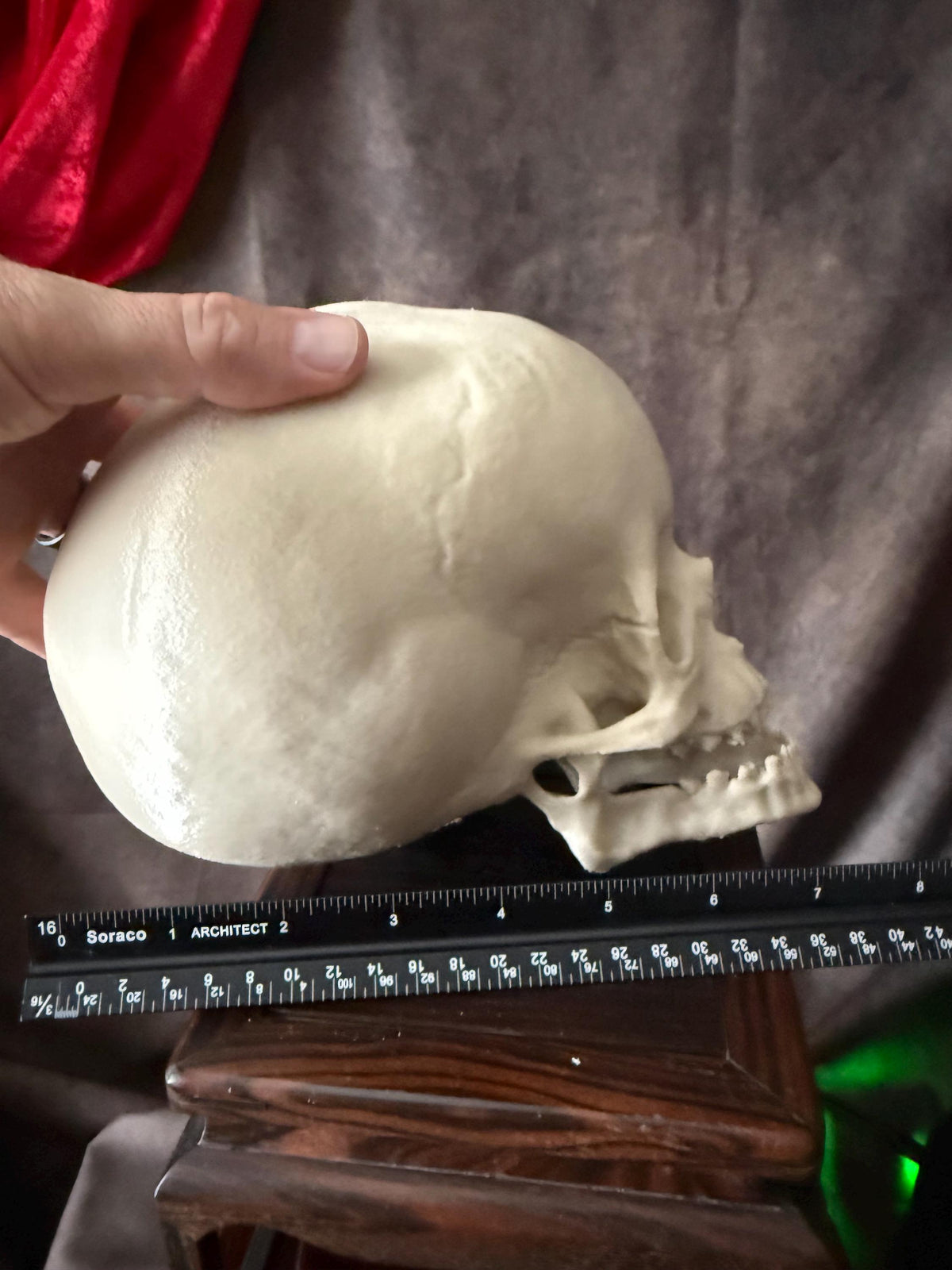 Hydrocephalus Skull child Replica | Gothic Medical Oddity Display