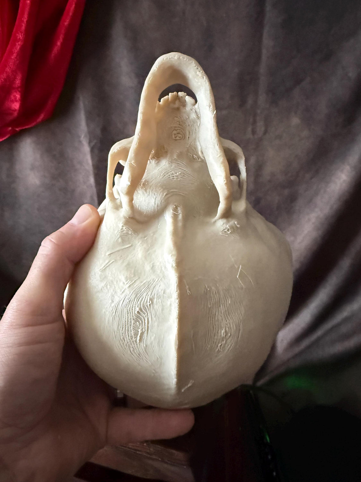 Hydrocephalus Skull child Replica | Gothic Medical Oddity Display