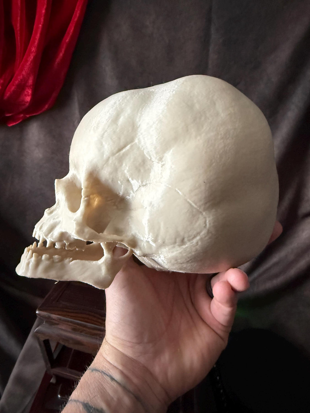 Hydrocephalus Skull child Replica | Gothic Medical Oddity Display
