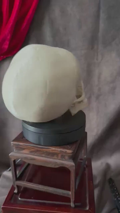 Hydrocephalus Skull child Replica | Gothic Medical Oddity Display